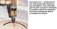 Амниоцентез - необязательное обследование беременной женщины