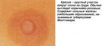 Ареола - круглый участок вокруг соска на груди
