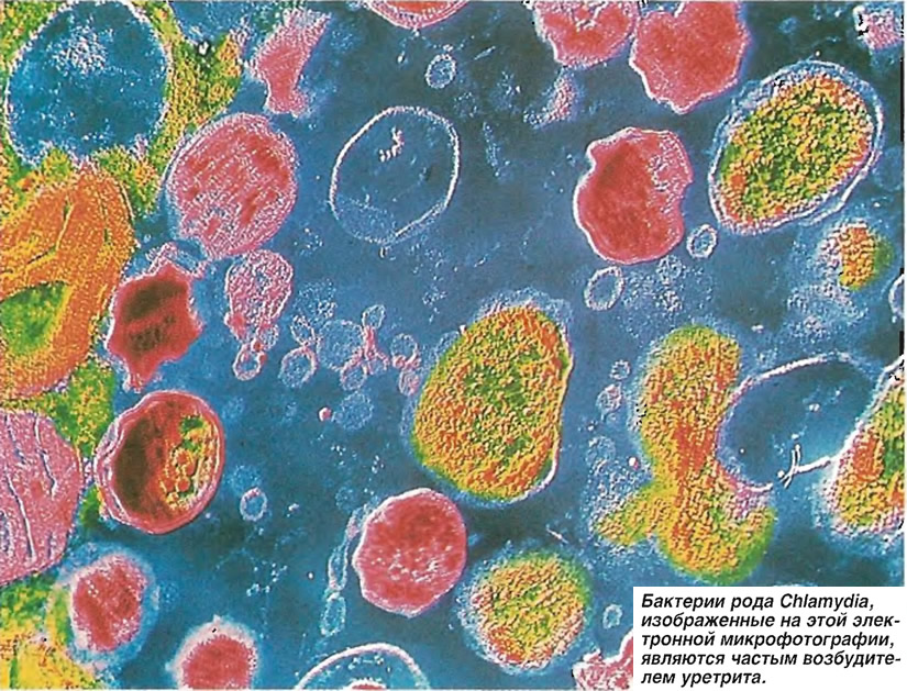 Бактерии рода Chlamydia