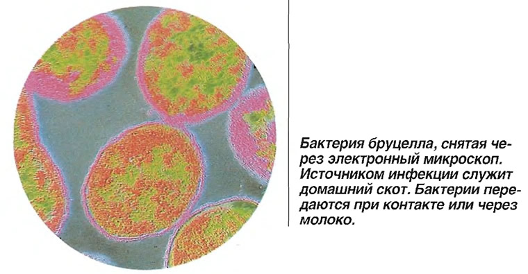 Бактерия бруцелла, снятая через электронный микроскоп
