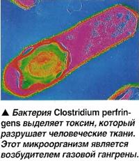 Бактерия Clostridium perfringens выделяет токсин, который разрушает ткани