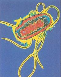 Бактерия Е.coli является основной причиной большинства заболеваний мочевых путей
