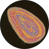 Бактерия Haemophilus influenzae типа В