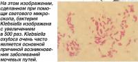 Бактерия Klebsiella изображена с увеличением в 500 раз
