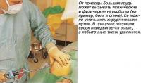 Большую грудь можно уменьшить хирургическим путем