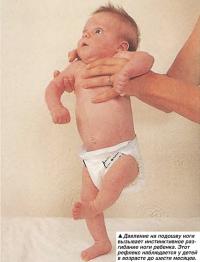Давление на подошву ноги вызывает инстинктивное разгибание ноги ребенка