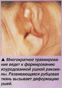 Деформация уха