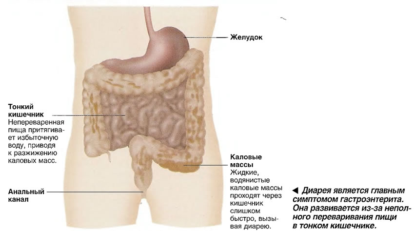 Que tomar para la gastroenteritis