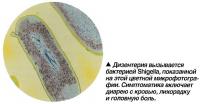 Дизентерия вызывается бактерией Shigella