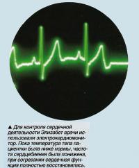 Для контроля сердечной деятельности Элизабет врачи использовали электрокардиомонитор