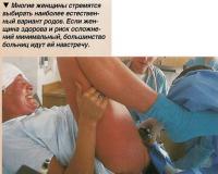 Естественный вариант родов