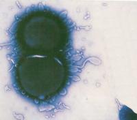 Этот снимок показывает менингококковую бактерию Neisseria meningitidis