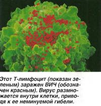 Этот Т-лимфоцит (показан зеленым) заражен ВИЧ (обозначен красным)