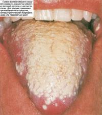 Грибок Candida albicans