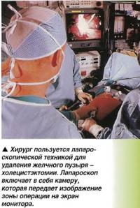 Холецистэктомия