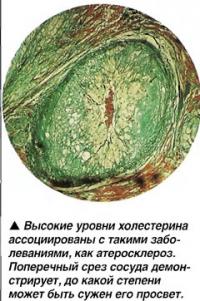 Холестерин