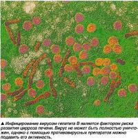 Инфицирование вирусом гепатита В является фактором риска развития цирроза печени