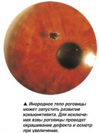 Инородное тело