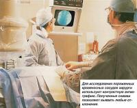 Исследование пораженных сосудов с помощью контрастной ангиографию