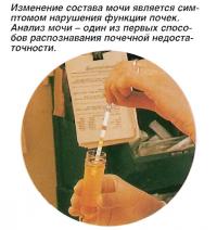 Изменение состава мочи является симптомом нарушения функции почек