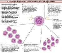 Как формируются злокачественные лимфоциты
