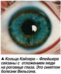Кольца Кайзера - Флейшера связаны с отложением меди на роговице глаза.
