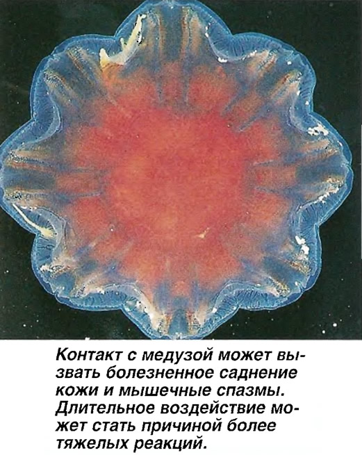 Контакт с медузой может вызвать болезненное саднение кожи и мышечные спазмы