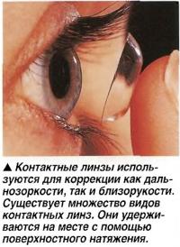 Контактные линзы