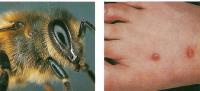 Лекарственный препарат апис представлят собой экстракт из измельченных пчел