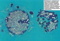 Лимфоциты взяты у пациента, прошедшего лечение специфическими антителами