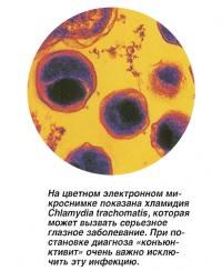 На цветном электронном микроснимке показана хламидия Chlamydia trachomatis