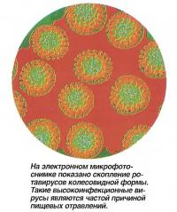 На электронном снимке показано скопление ротавирусов колесовидной формы