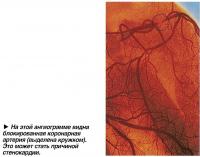 На этой ангиограмме видна блокированная коронарная артерия
