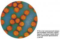 На этой электронной микрофотографии показаны аденовирусы