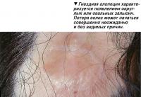 На этой микрофотографии корня волоса показан волосяной фолликул