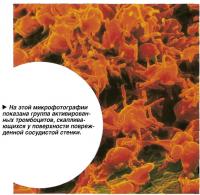 На этой микрофотографии показана группа активированных тромбоцитов