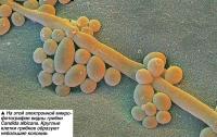 На этой микрофотографии видны грибки Candida albicans