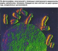 На фотографии, полученной с помощью электронного микроскопа, видны хромосомы человека