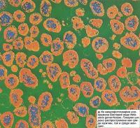На микрофотографии изображена бактерия вида Neisseria gonorrhoeae