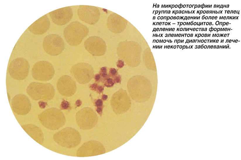 На микрофотографии видна группа красных кровяных телец