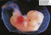 На пятой неделе можно видеть пупочный канатик эмбриона и сетчатку глаза