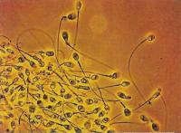 На световом микроснимке показаны плавающие сперматозоиды