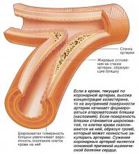 На внутренней поверхности артерии начинает формироваться атероматозная бляшка