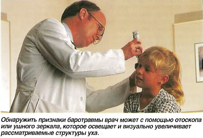 Обнаружить признаки баротравмы врач может с помощью отоскопа или ушного зеркала