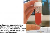 Образцы ворсин хориона