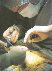 Операция завершена, хирург зашивает пять внешних разрезов брюшной стенки