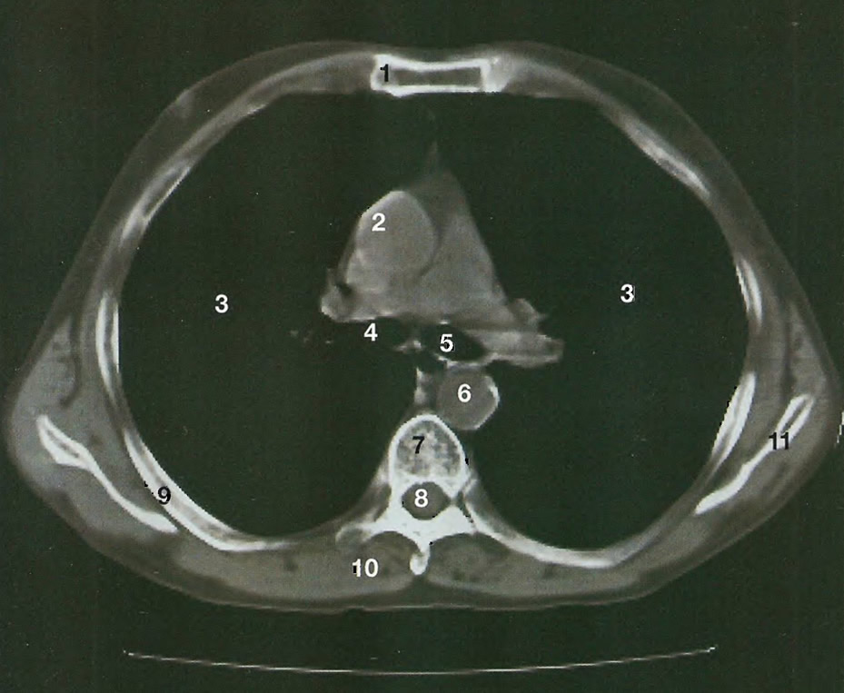 Основные отмеченные структуры на рентгенограмме