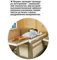 Пациент проходит процедуру литотрипсии