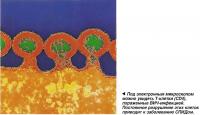 Под электронным микроскопом можно увидеть Т-клетки (CD4), пораженные ВИЧ-инфекцией