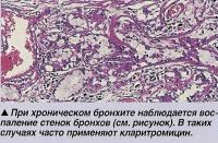 При хроническом бронхите наблюдается воспаление стенок бронхов